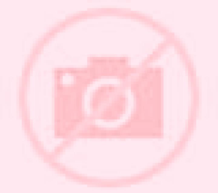 Andrea 3 Canar escort