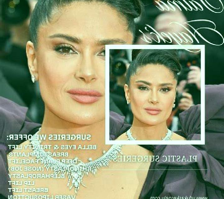 Aurora Hoyorredondo escort