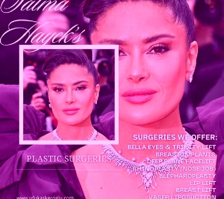 Estrella Infiesto escort