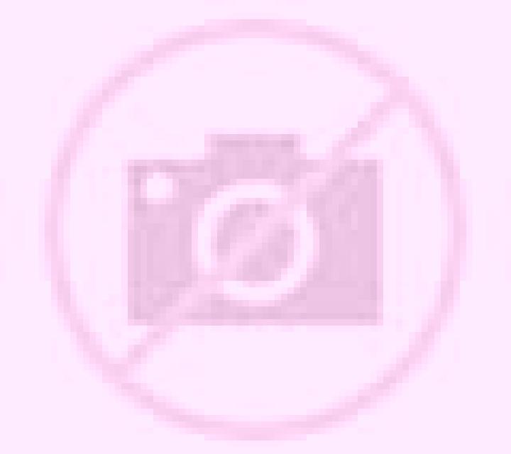 Lola 2 Povedilla escort