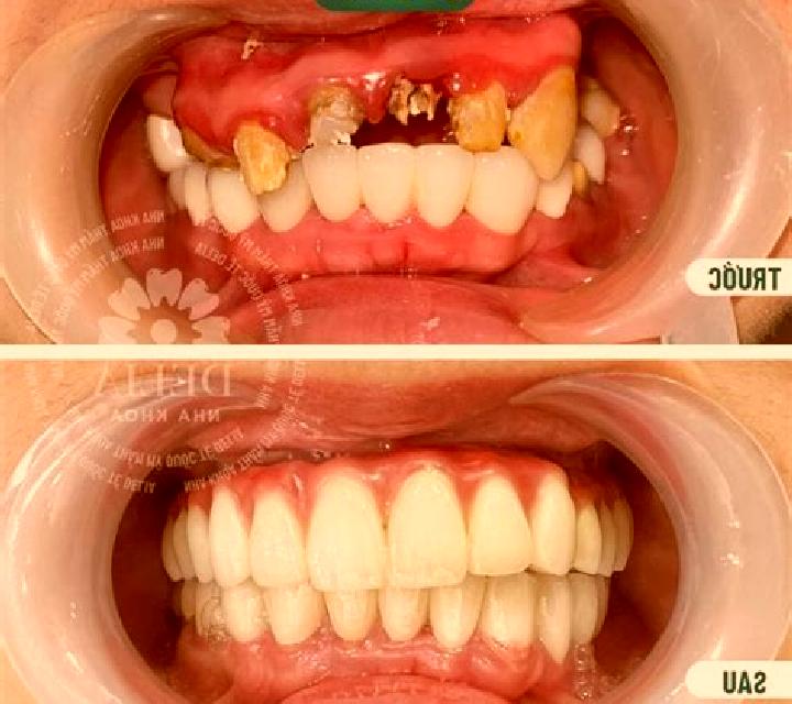 Nadia Villamanin escort