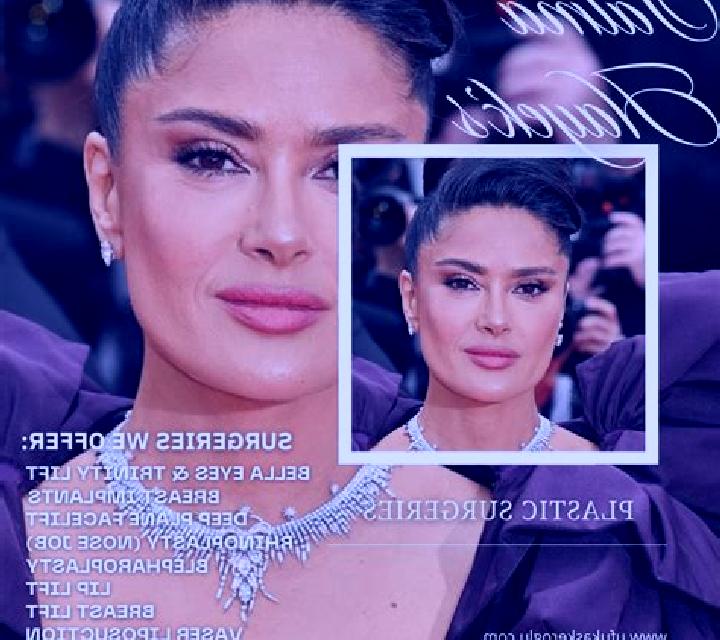 Noa 3 Salce escort