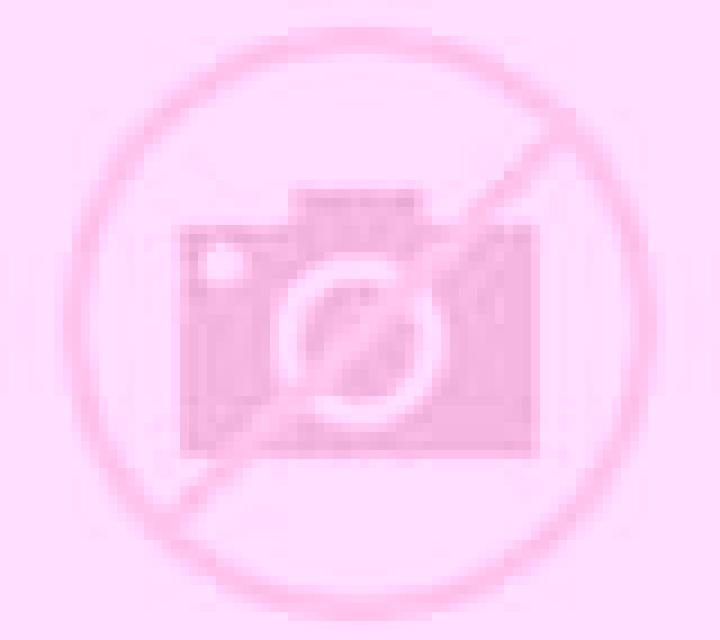 Yasmin 2 Sotragero escort
